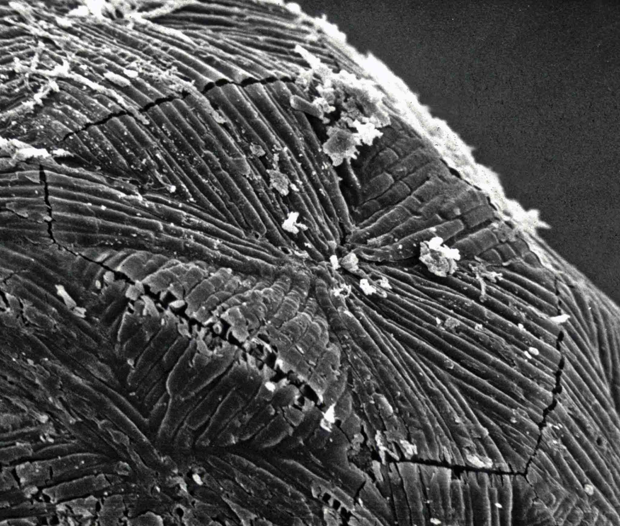 Представитель Семейства Cephalothecaceae
